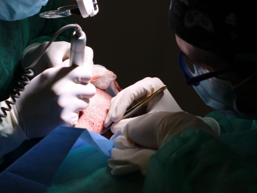 Procedimiento de Implante Capilar FUE Zafiro